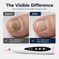 🔥NOVO ARTIGO MAIS VENDIDO❤️‍🔥 Aparelho Elétrico para Unhas 2-em-1 com Luz UV Portátil Kit Manicure e Pedicure